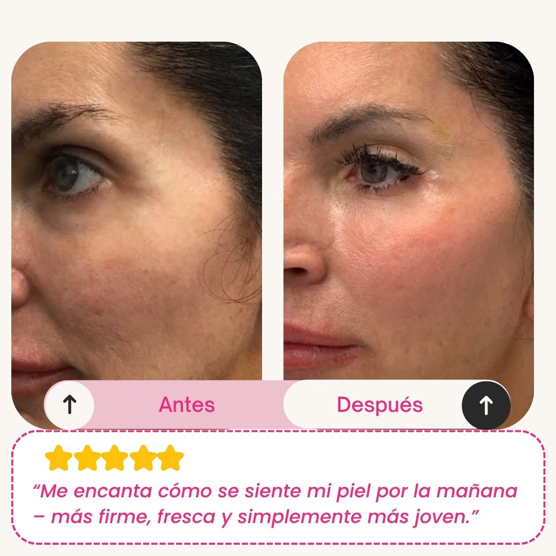 Skinly - Mascarilla de Colágeno y Péptidos de Acción Profunda