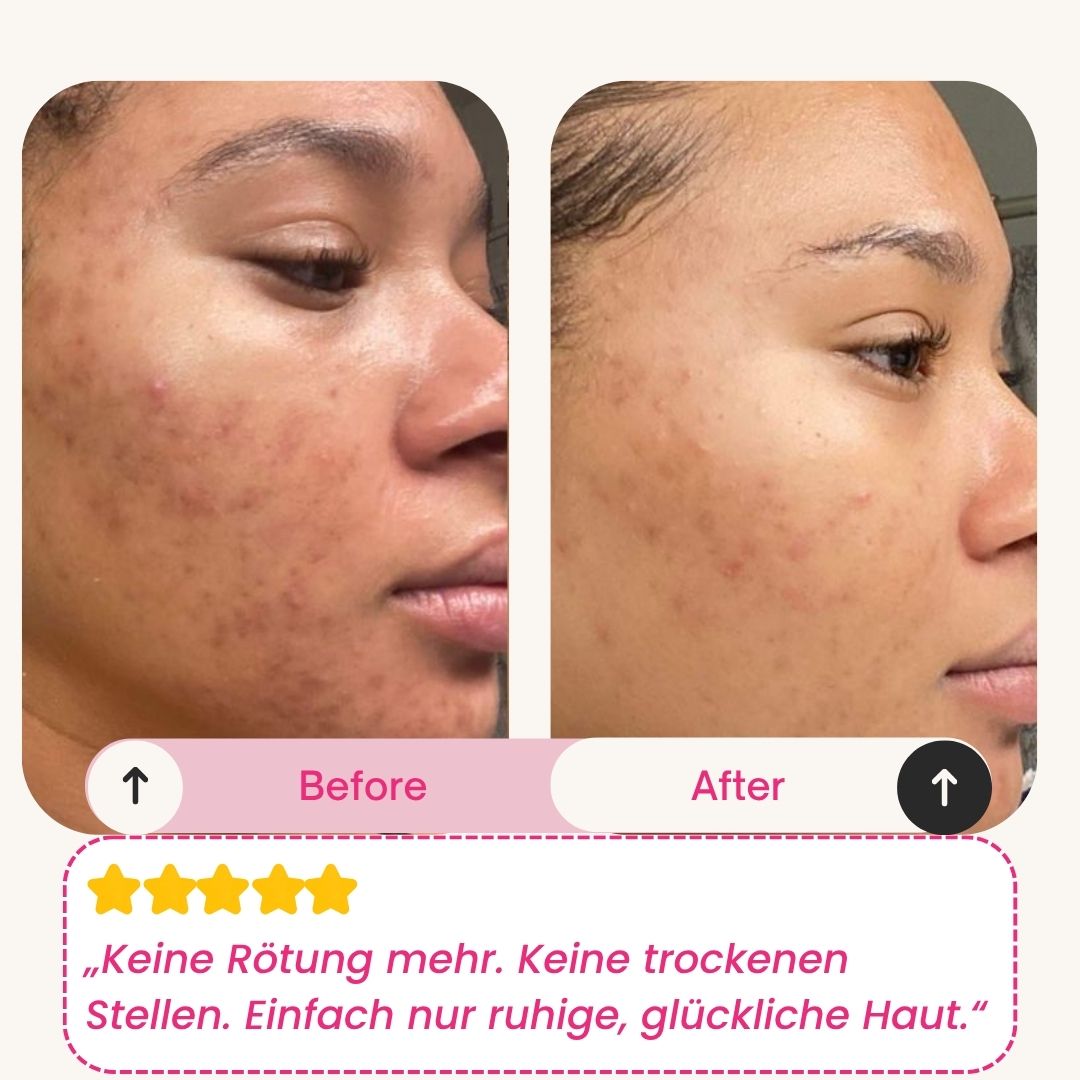 Skinly - Deep Peptide Collagen Mask