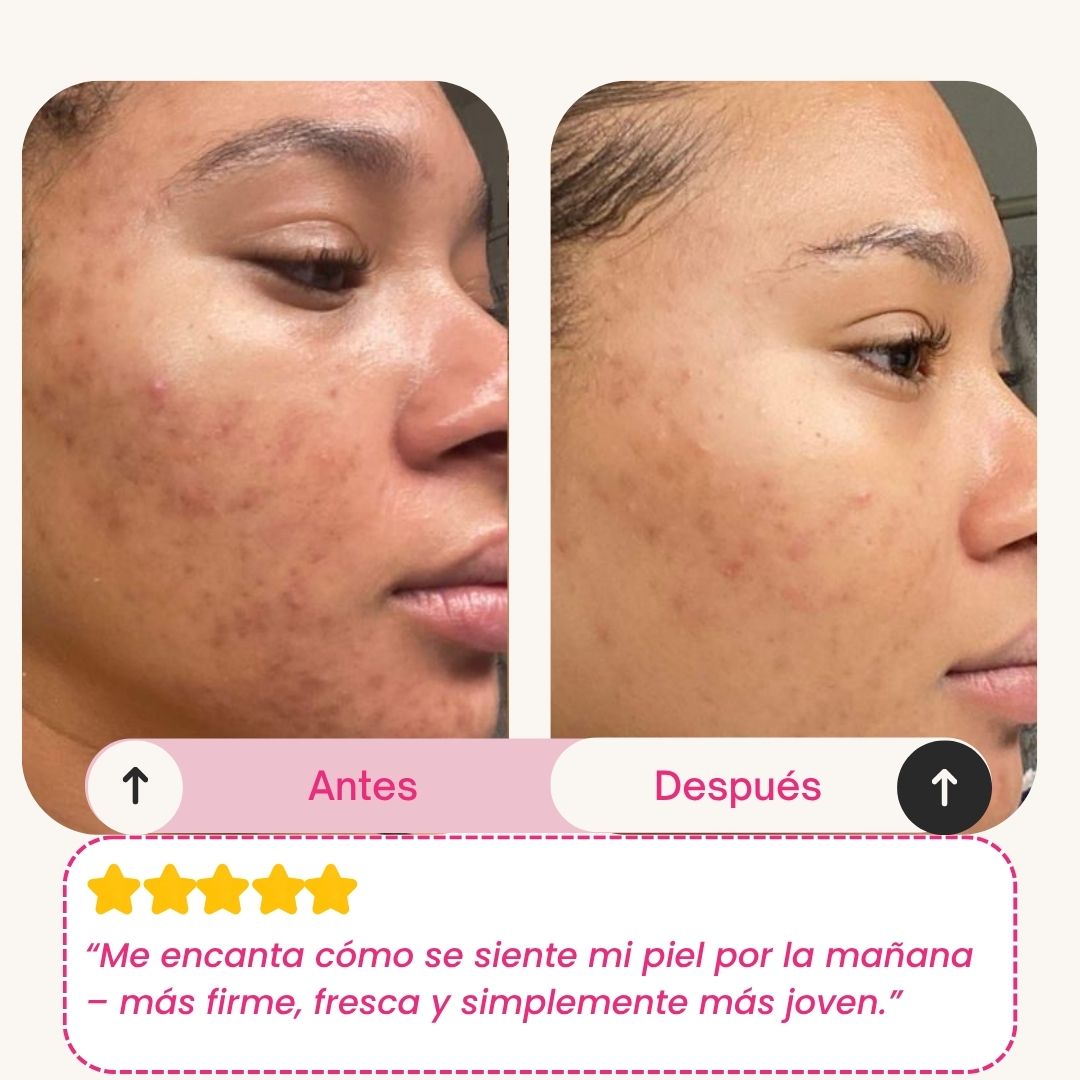 Skinly - Mascarilla de Colágeno y Péptidos de Acción Profunda