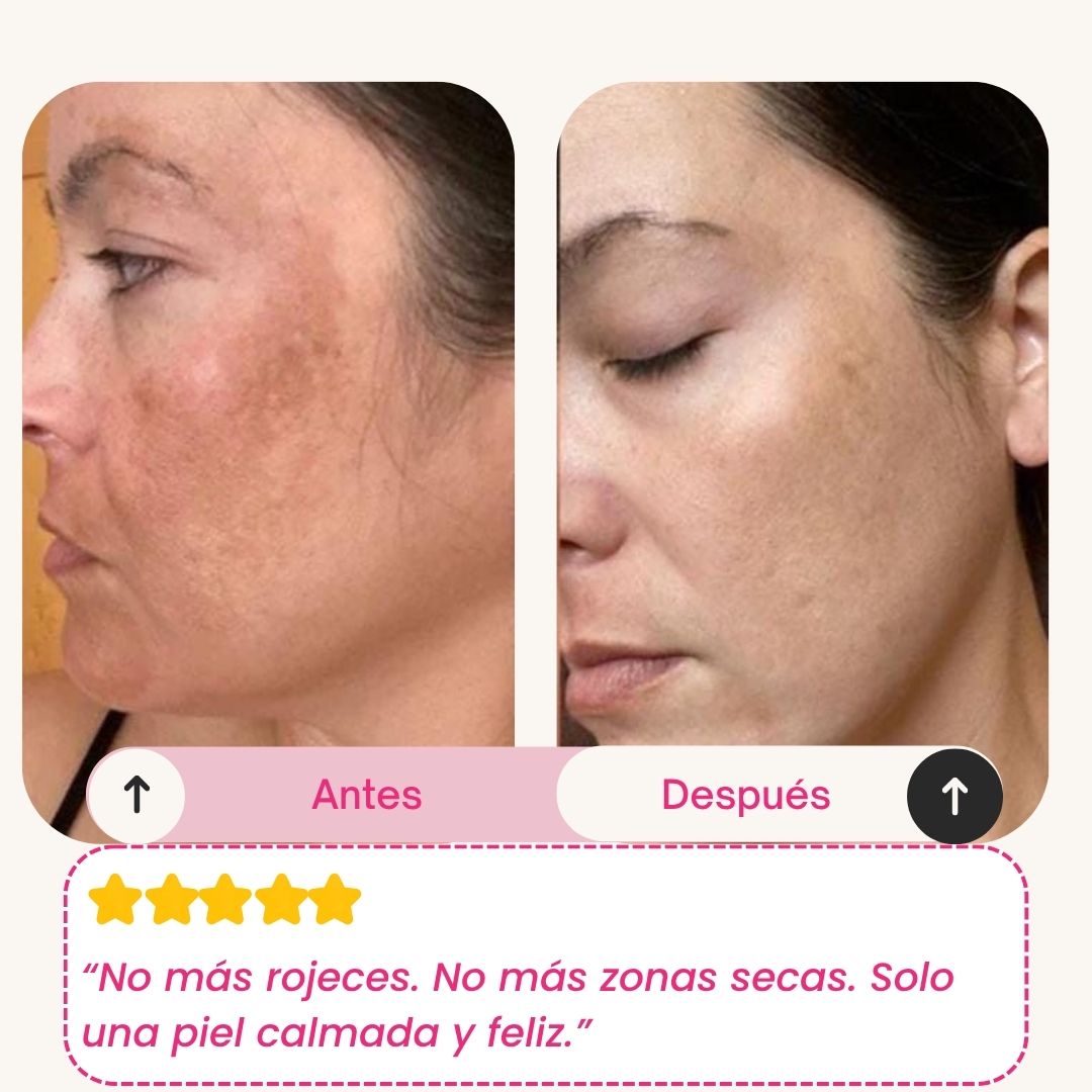 Skinly - Mascarilla de Colágeno y Péptidos de Acción Profunda