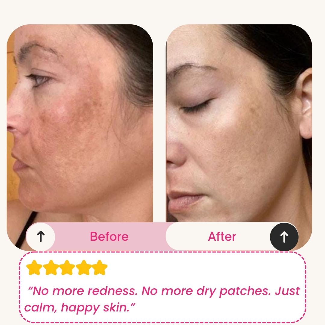 Skinly - Deep Peptide Collagen Mask