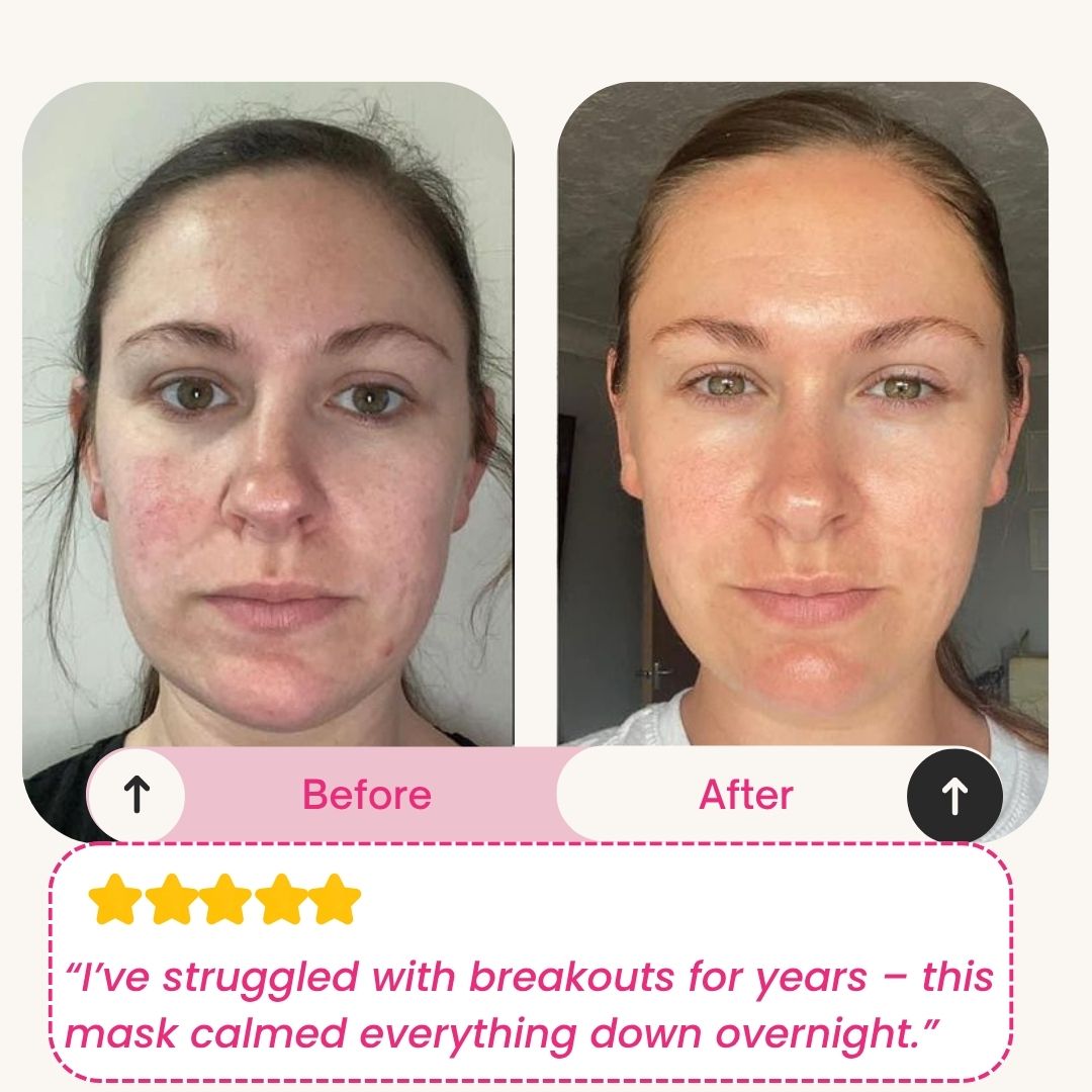 Skinly - Deep Peptide Collagen Mask
