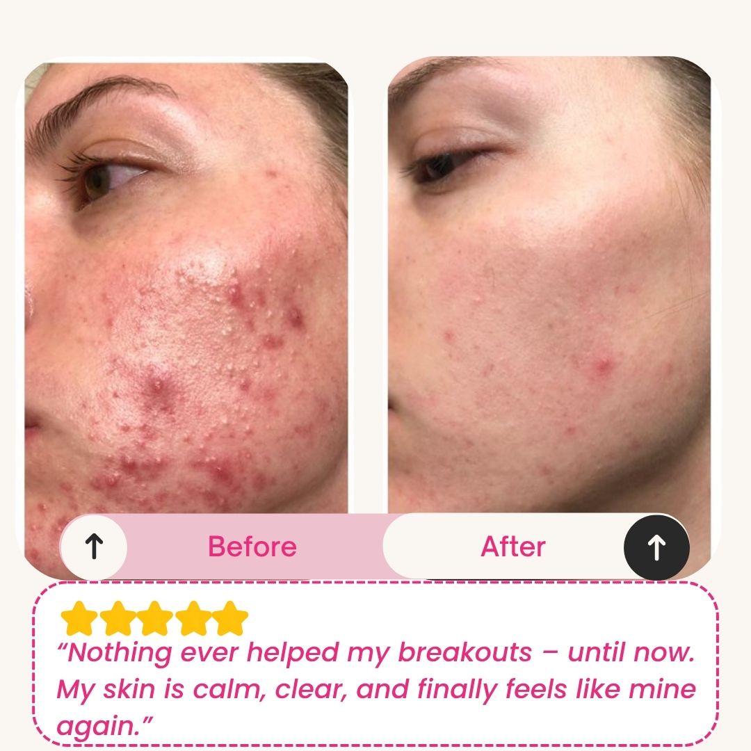 Skinly - Deep Peptide Collagen Mask