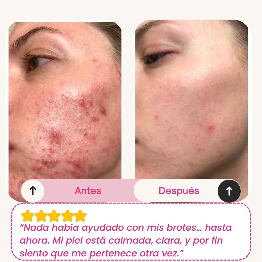 Skinly - Mascarilla de Colágeno y Péptidos de Acción Profunda