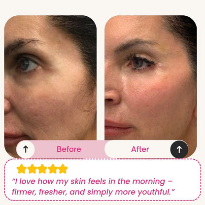 Skinly - Deep Peptide Collagen Mask