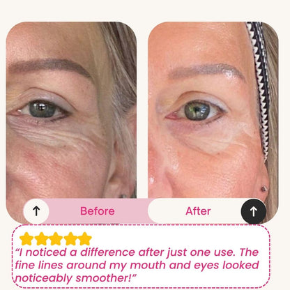 Skinly - Deep Peptide Collagen Mask