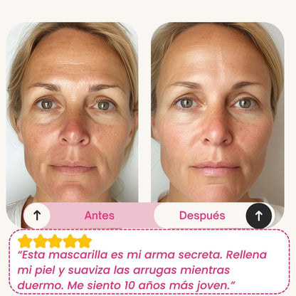 Skinly - Mascarilla de Colágeno y Péptidos de Acción Profunda