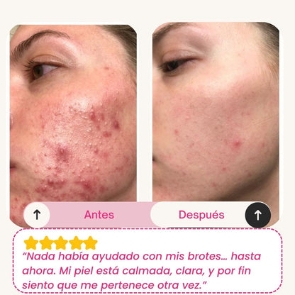 Skinly - Mascarilla de Colágeno y Péptidos de Acción Profunda