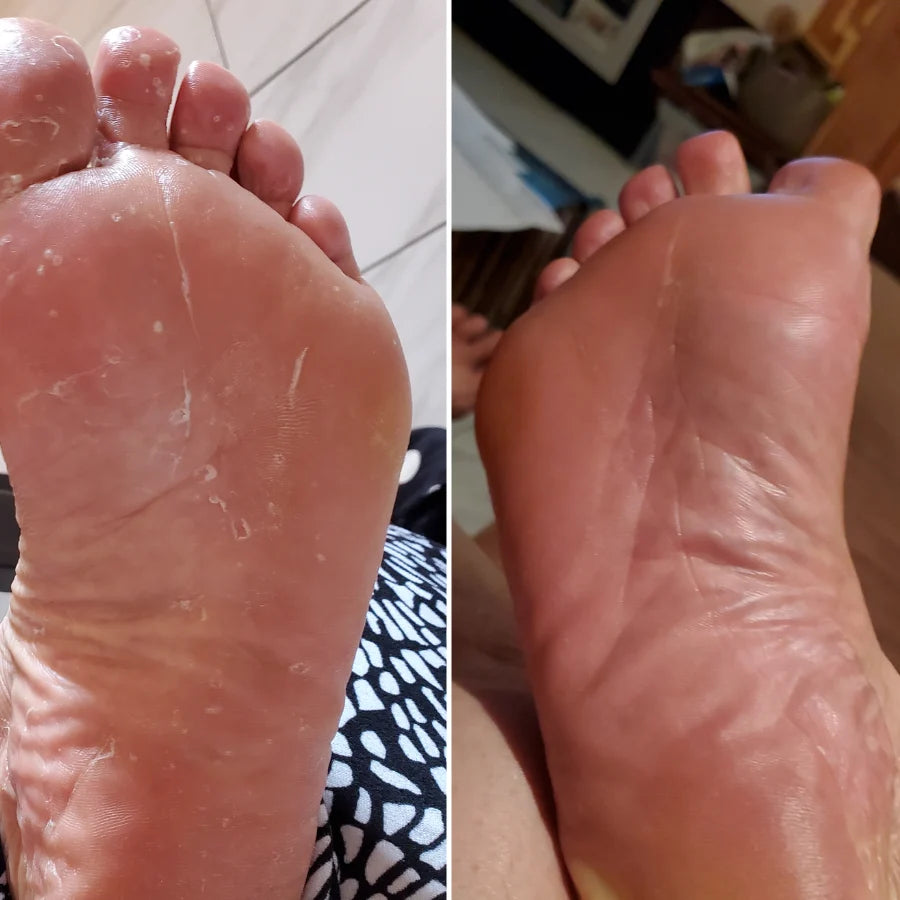 Veloma Antifungal Soap