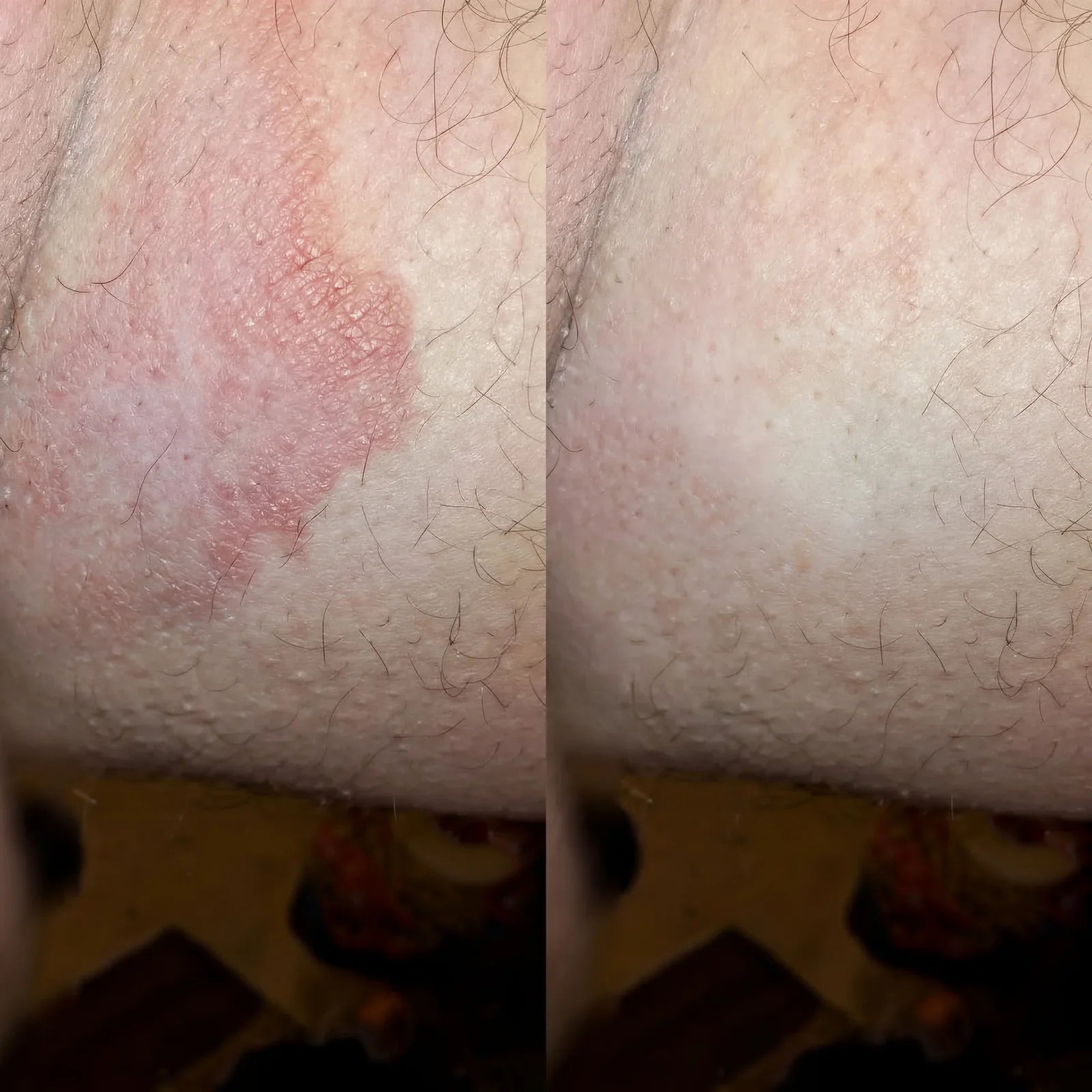 Veloma Antifungal Soap